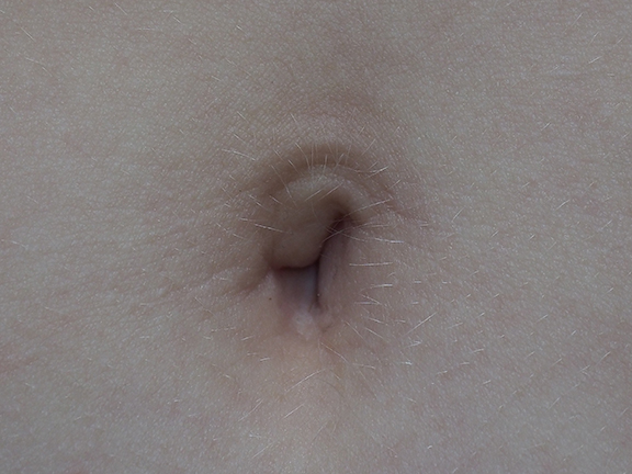 Poopitz 5220869.JPG
