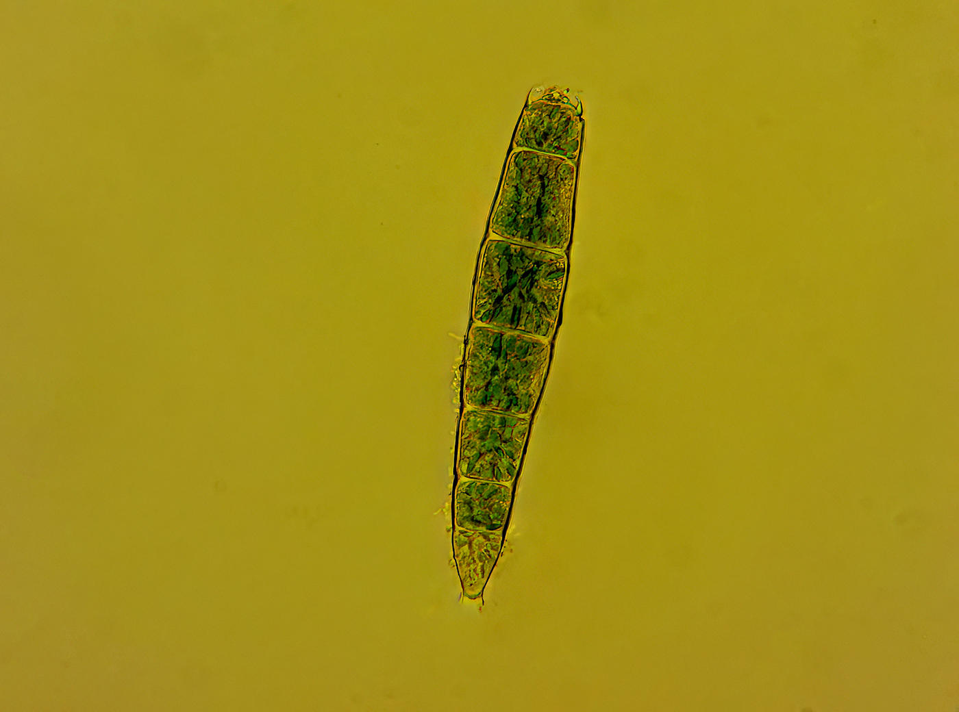 Rotifer  -Phylum rotifera-