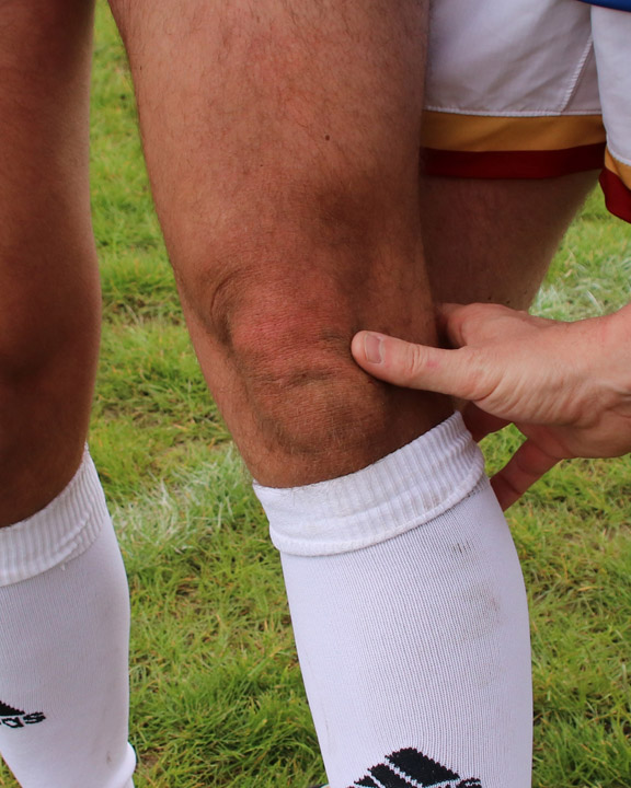 Ross Shows His Commitment By Getting Some Dirt On His Knee