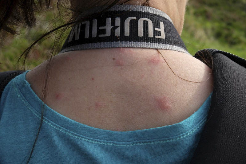 Knockan Crag, the appetite of mosquitoes