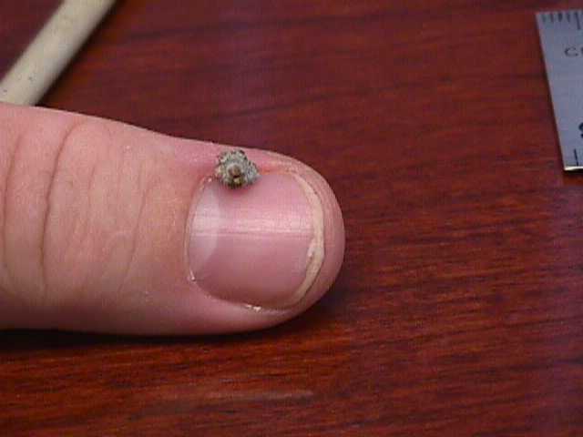 kidney-stones-aint-yer-friends_962832497_o.jpg