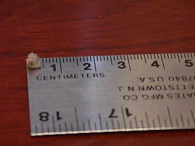 my-big-ol-kidney-stone_963686186_o.jpg