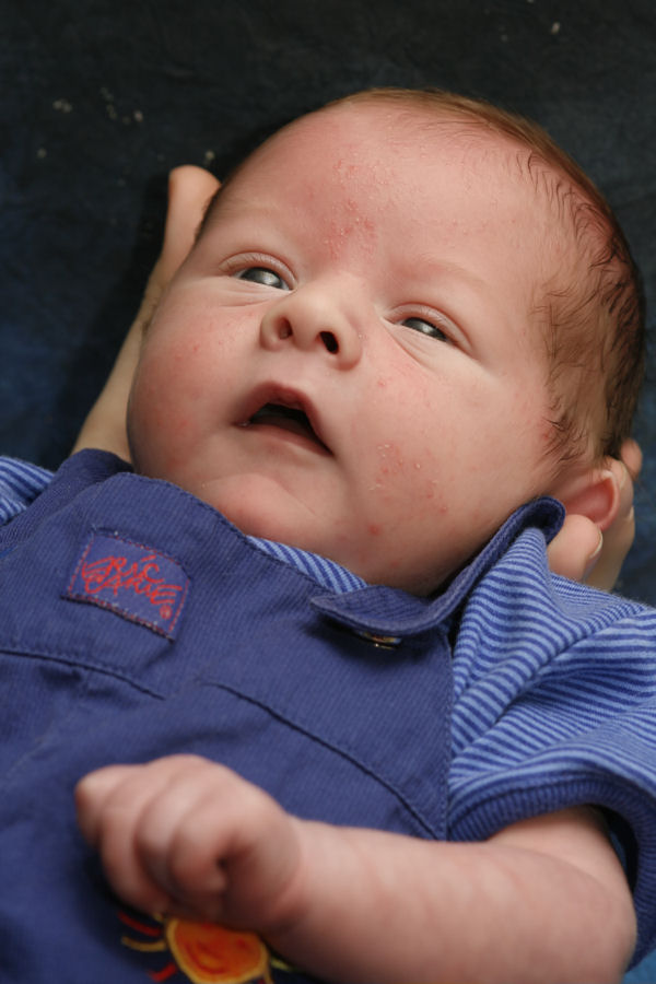 Jacob