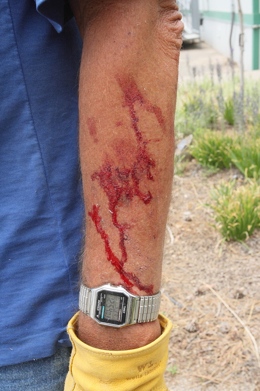 Rose Pruning Can Be Fun (8886)