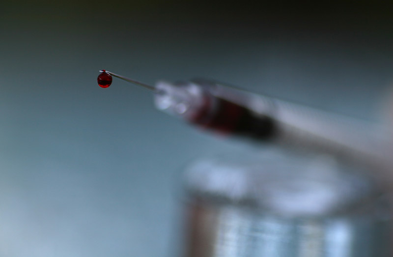 N is for Needle