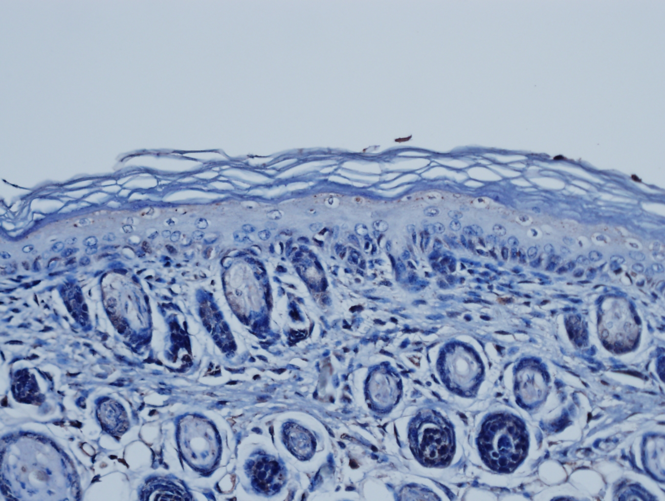 Image_mcp1_ntg_20X_Scale.tif