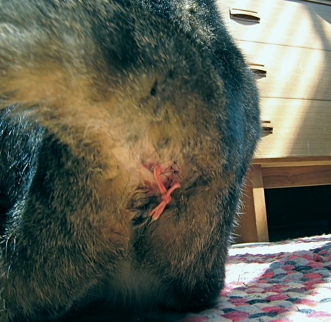 Chumley abcess surgery 5/17/08