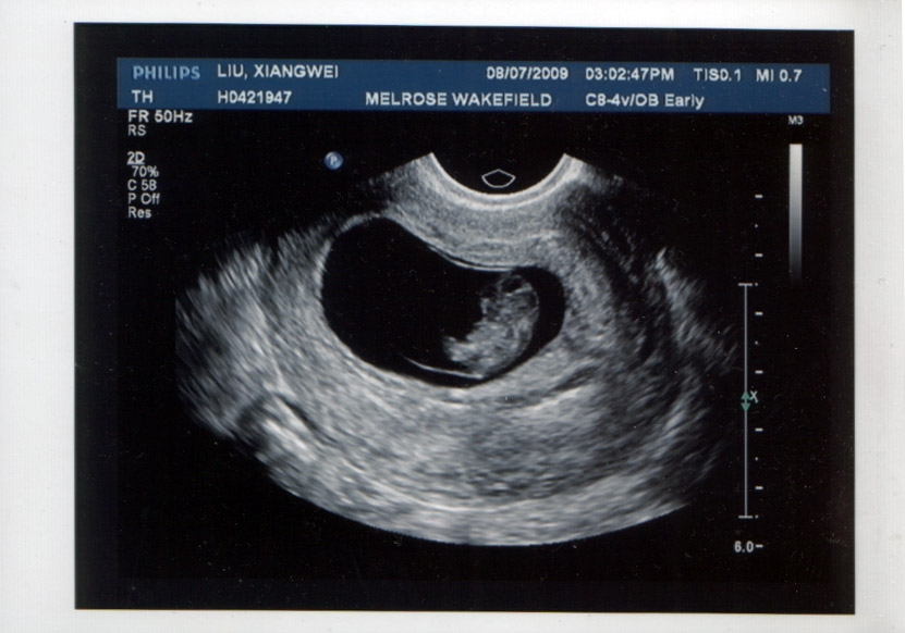 baby-1.JPG