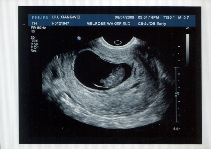 baby-3.JPG