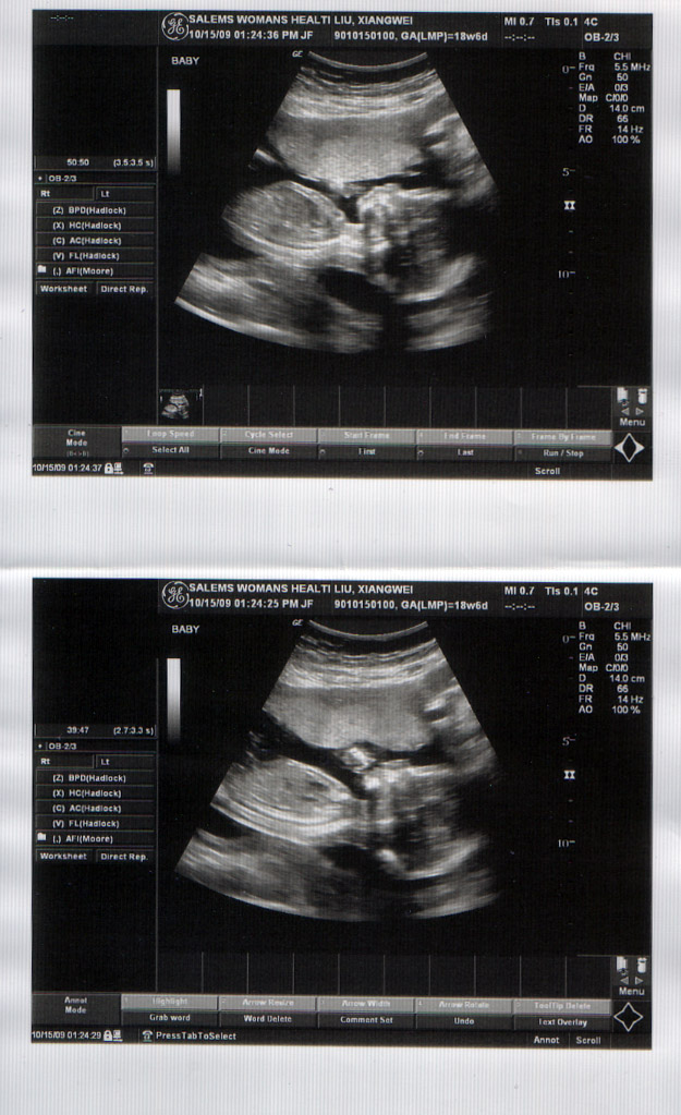baby-19.jpg