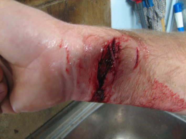 lacy bite low res.jpg