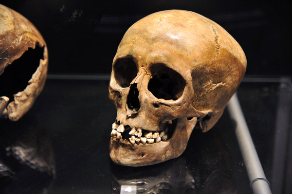 Skull of a young girl, 3500-3400 BC