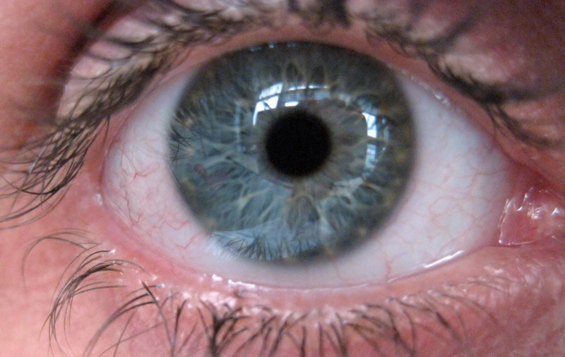 david self-eye
