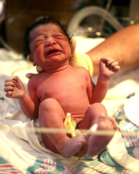 Birth