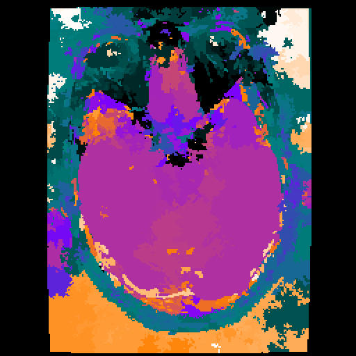 Brain y Eyeballs