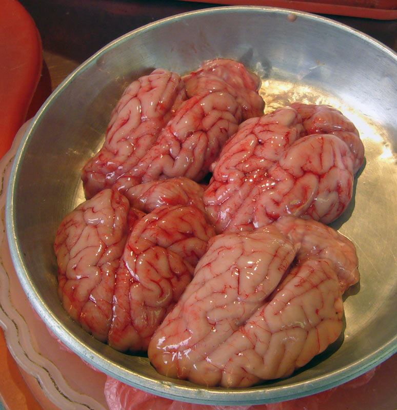 Brains