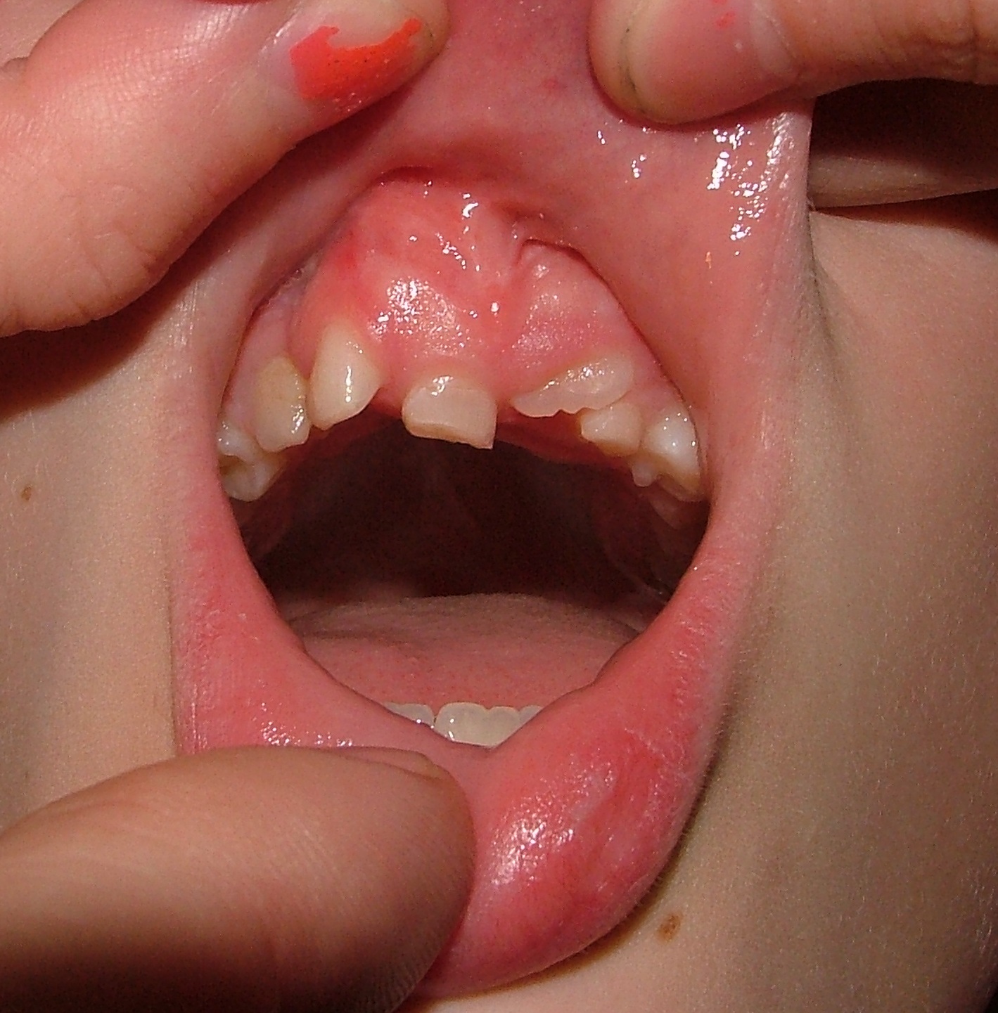 A little dental work here and there.