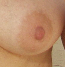 Breast Breast 005