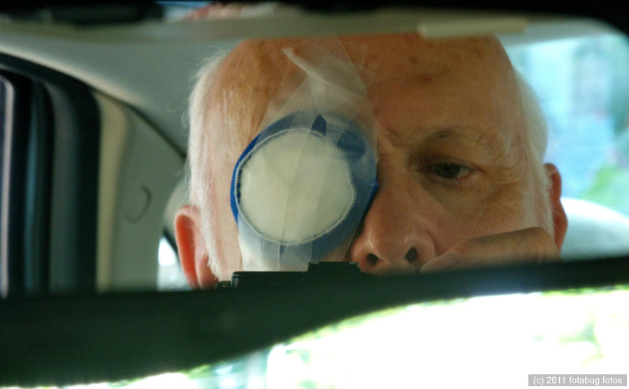 Rearview Mirror Self-Portrait, Just After Implant Surgery