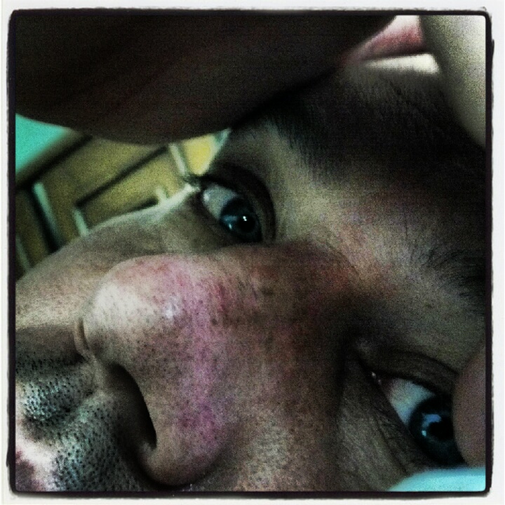 175:366<br>Down