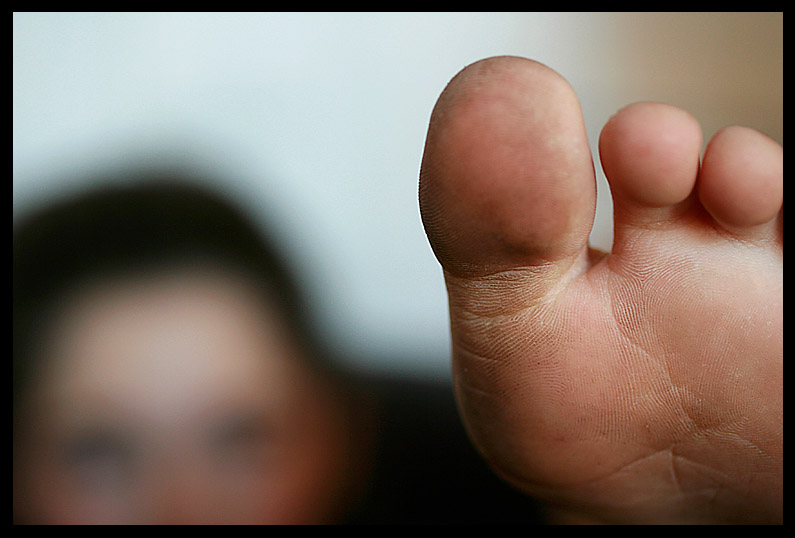 Feet