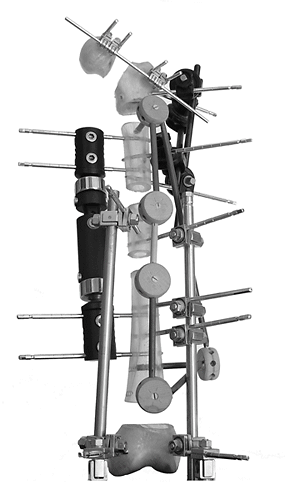 Tinker Toys
