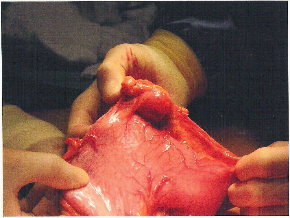 tumor1-Susie