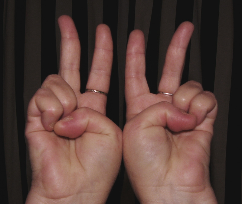 Bent fingers sign Peace by TonyL