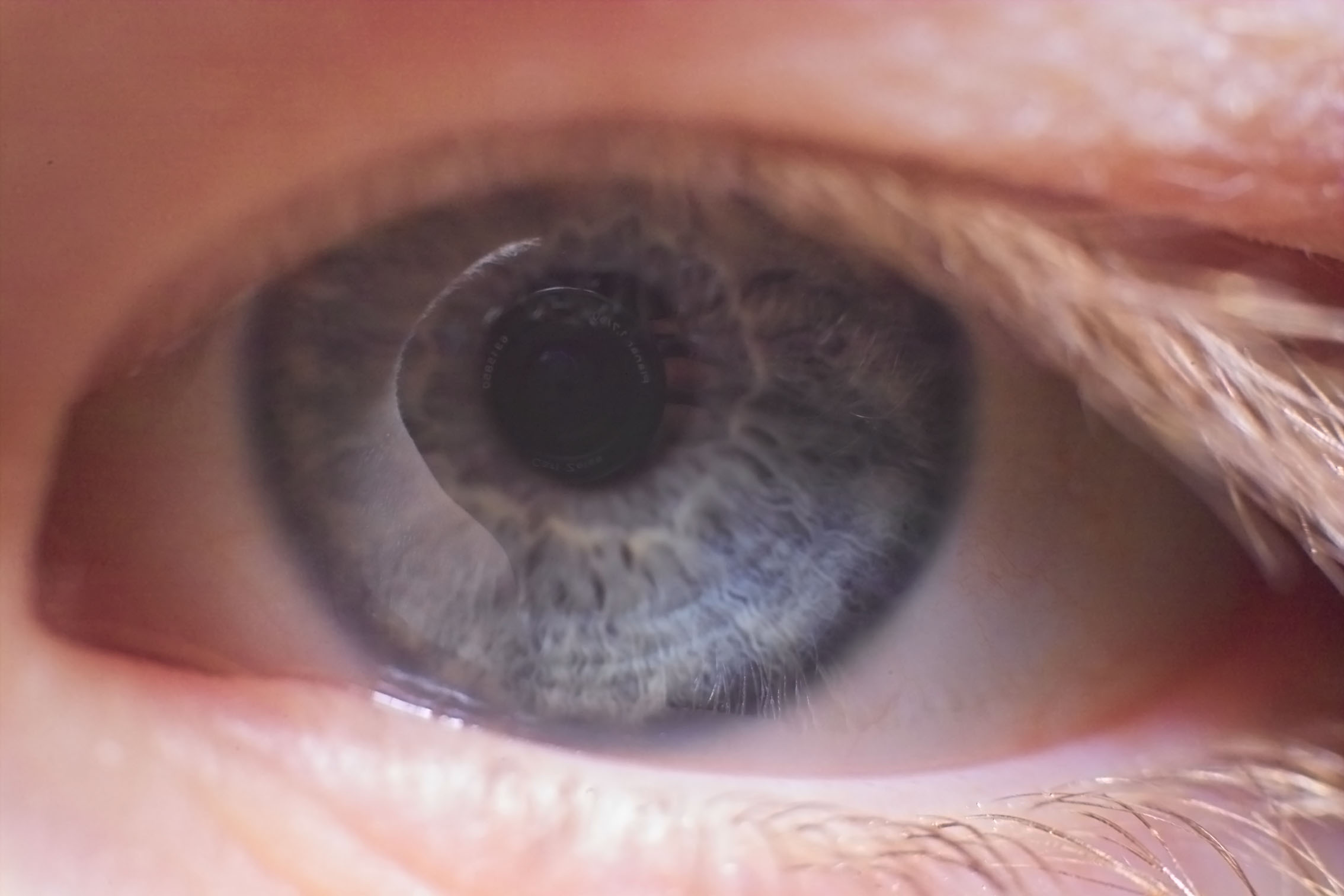 Two lenses by Mark M. Span