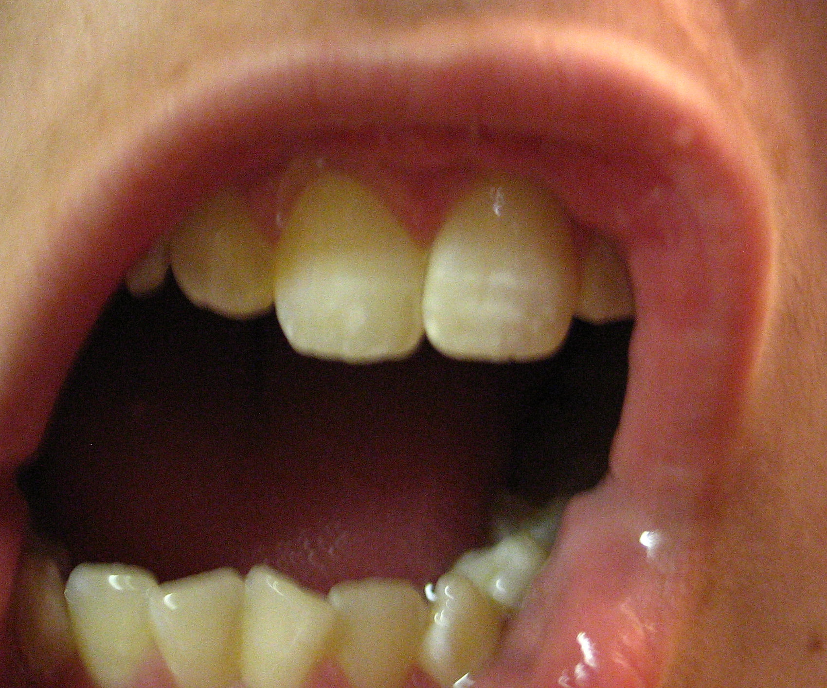 urrrrrrrrrrrrrrrrrr 2