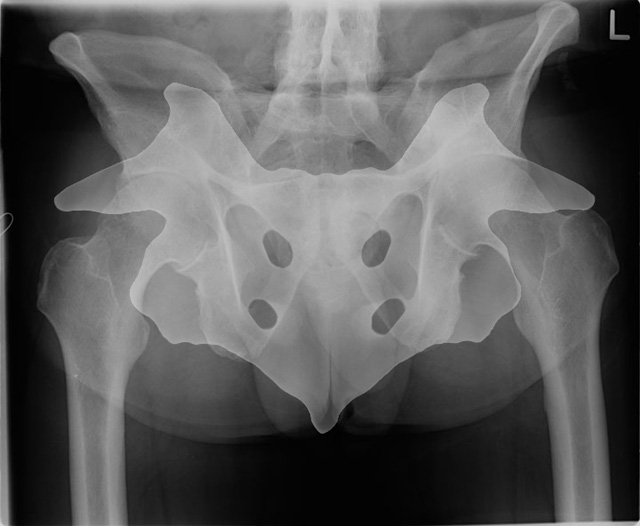 Pelvic-Rorschach.jpg