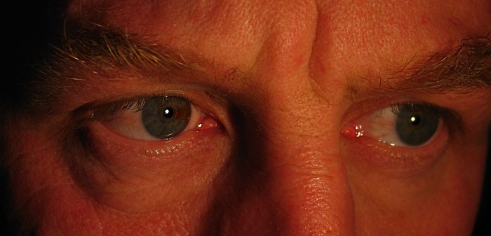 I Eye