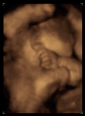 o4/72/541772/1/57768811.babyback.jpg