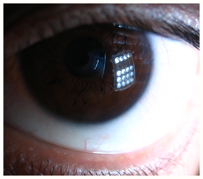 eye array