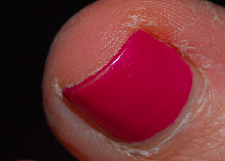 My Wifes Big Toe Reposted: My First Real Macro Shot