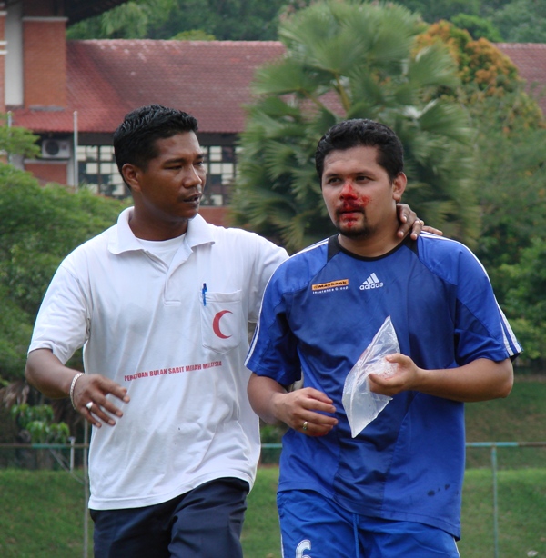 The Bloody Nose by Tabrizi