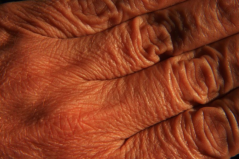 My hand (detail)