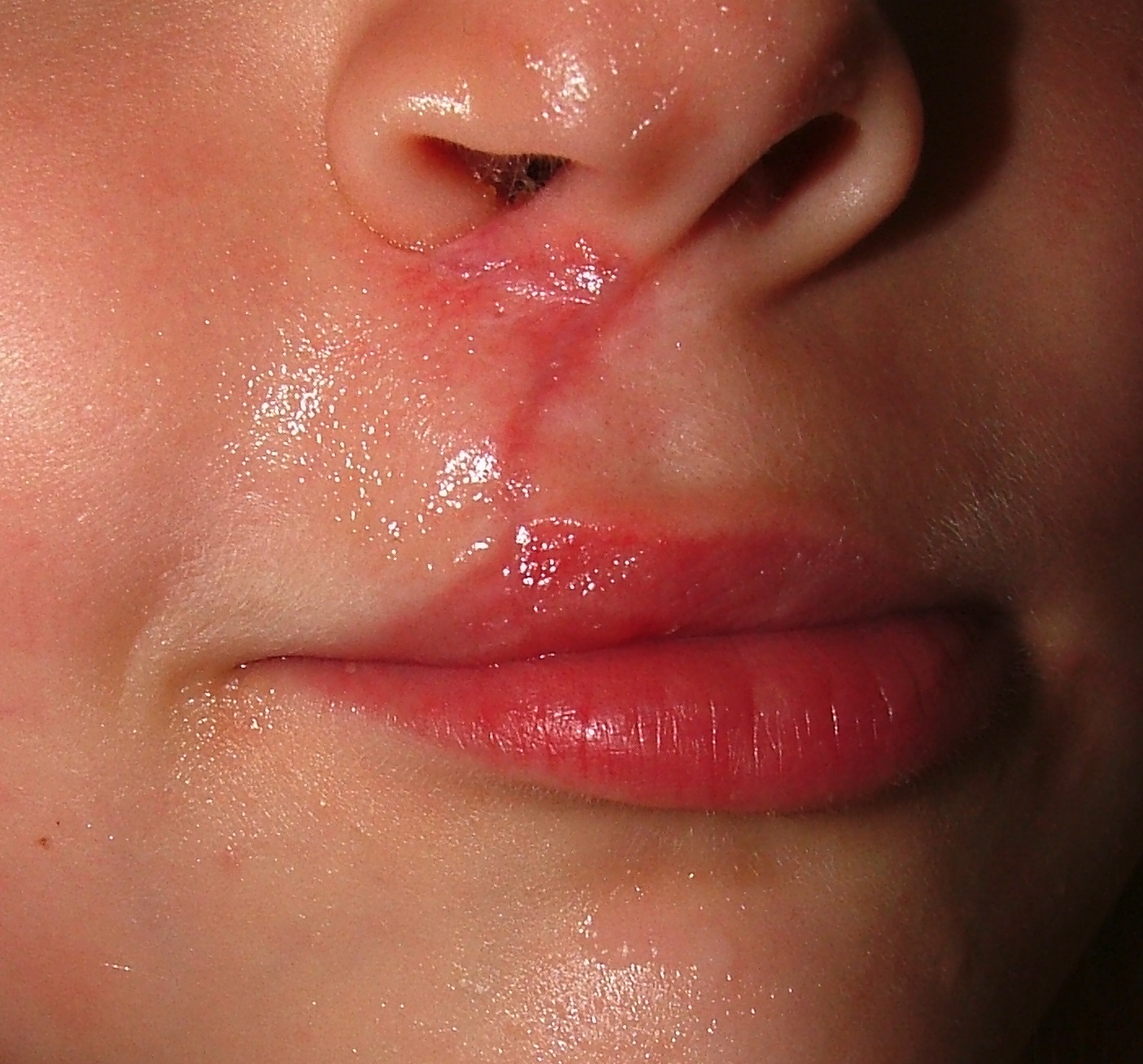 Post Operation 38th day