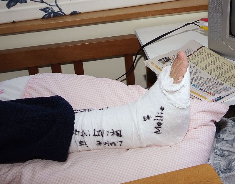 12 Jan 2010 - Hope's broken ankle cast