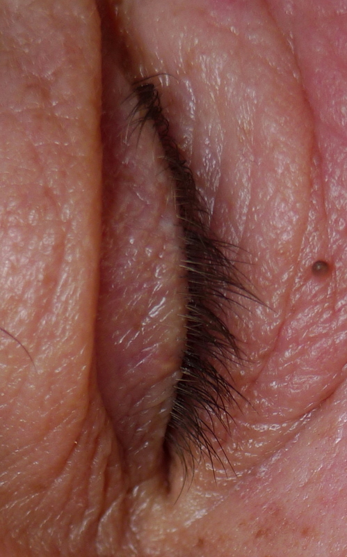 My closed eye
