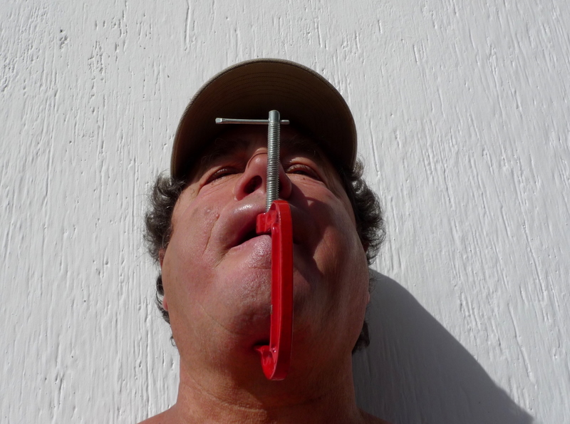 ... to attach dentures ....