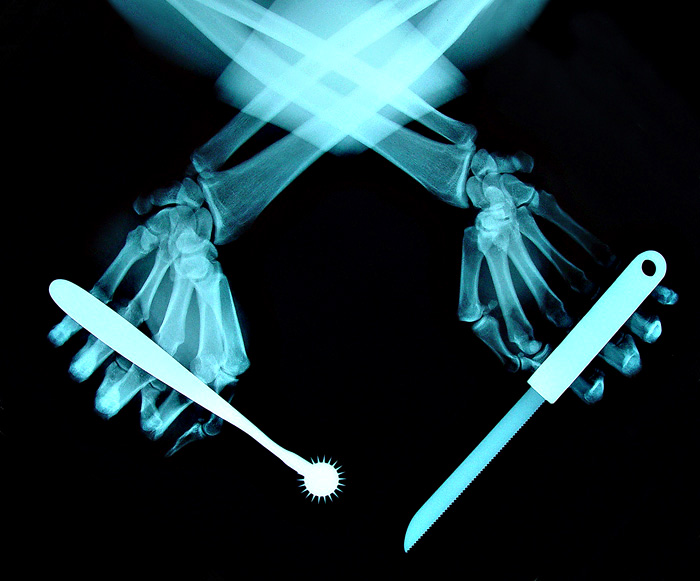 xray