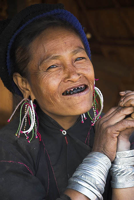 Eng woman shows off her blackened teeth, Myanmar