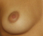 Breast Breast