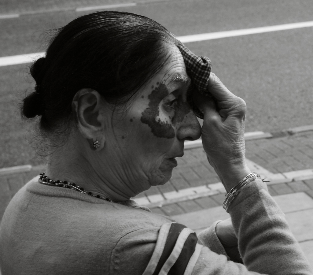 August 18  2008: <br> Scarred