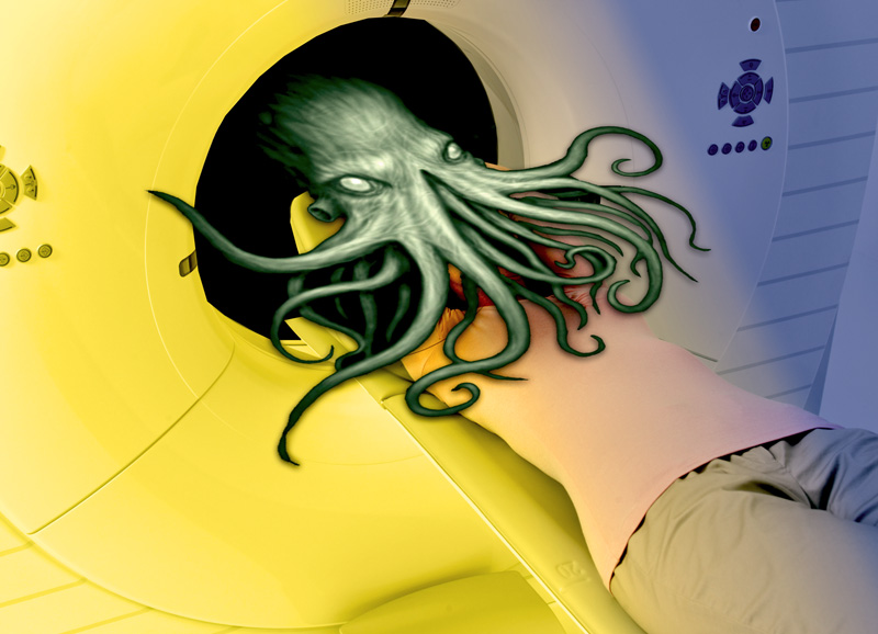 Cthulhu-MRI.jpg