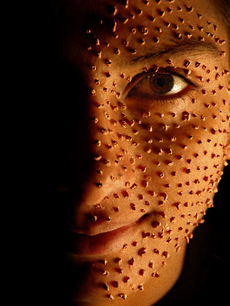 8th - Spotty *