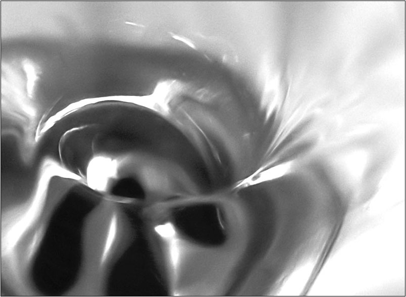 Vortex