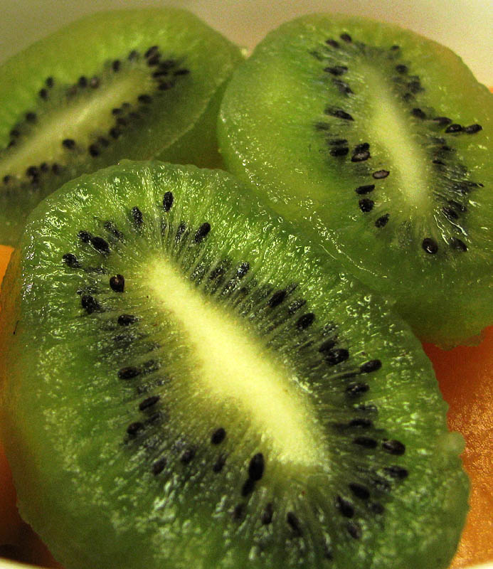 Kiwis