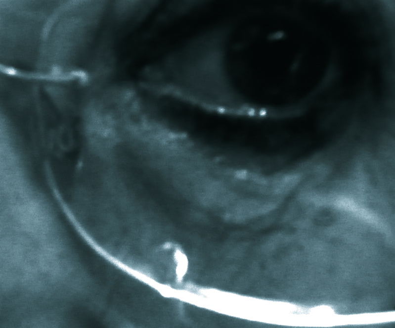 Glass tear